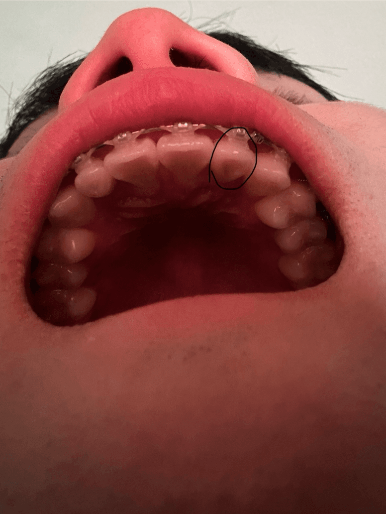 2번 째 사진