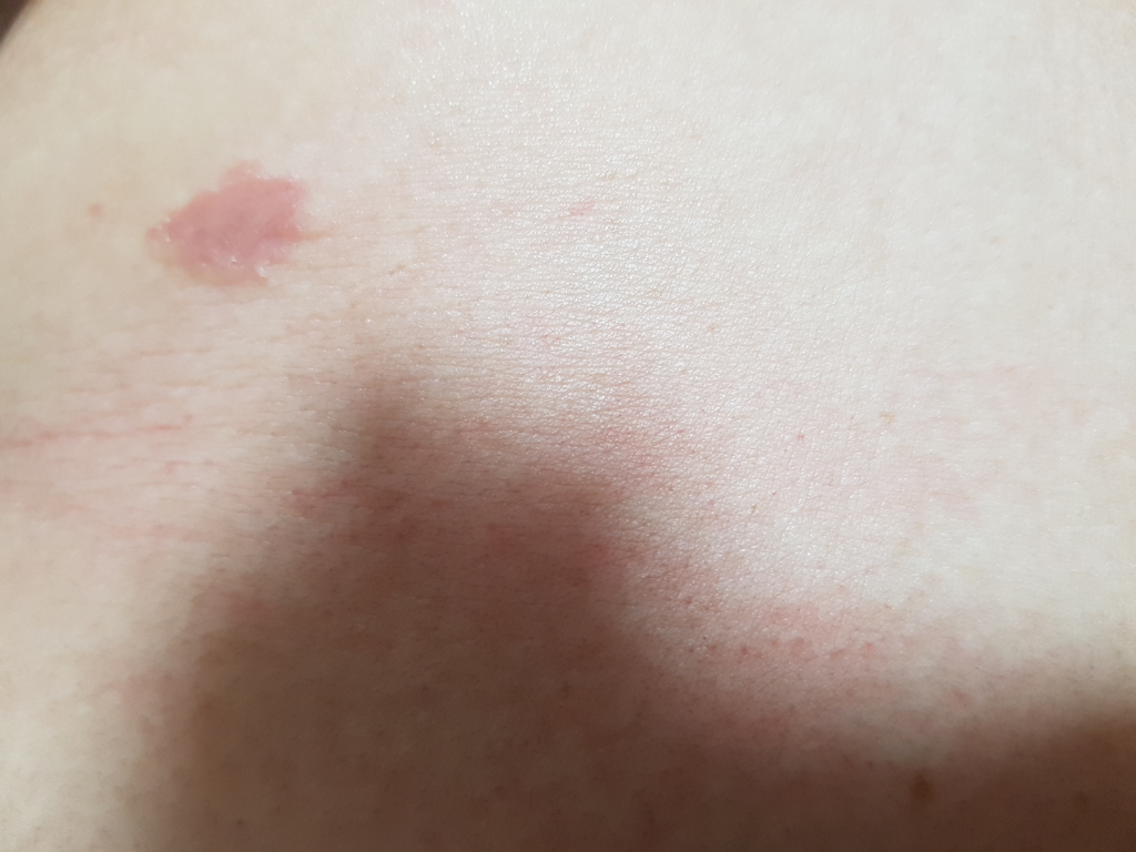 2번 째 사진