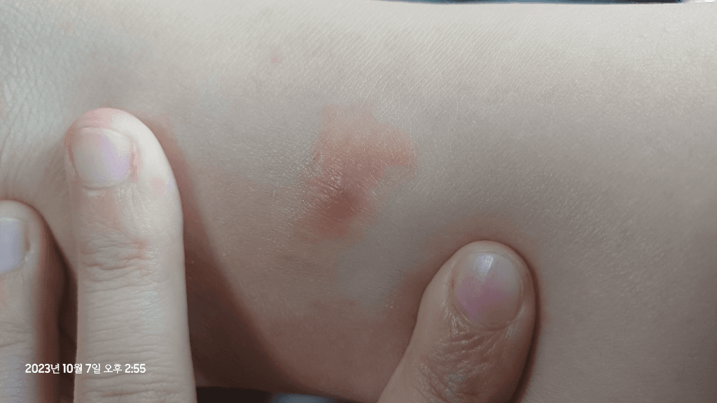 2번 째 사진