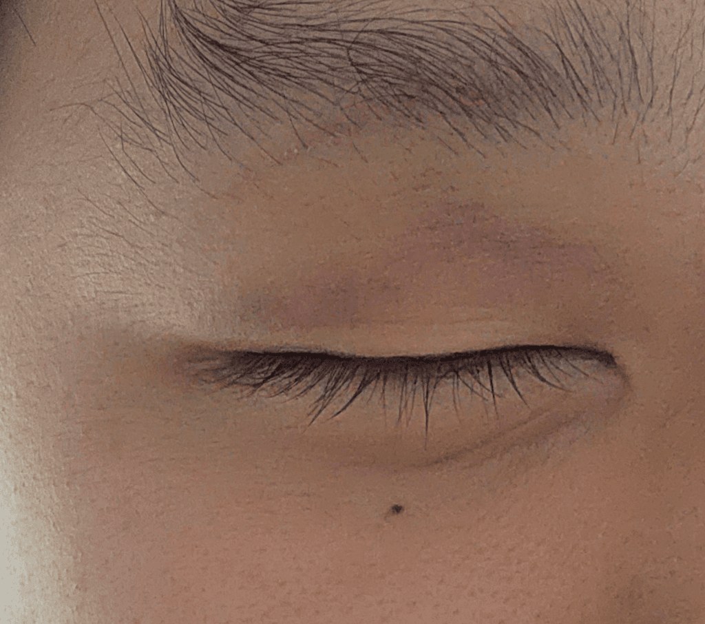 2번 째 사진