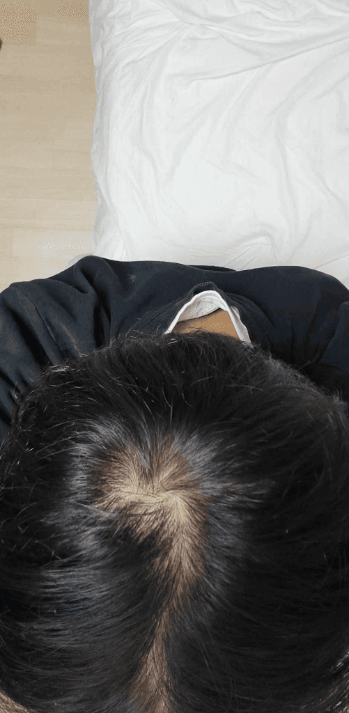 2번 째 사진