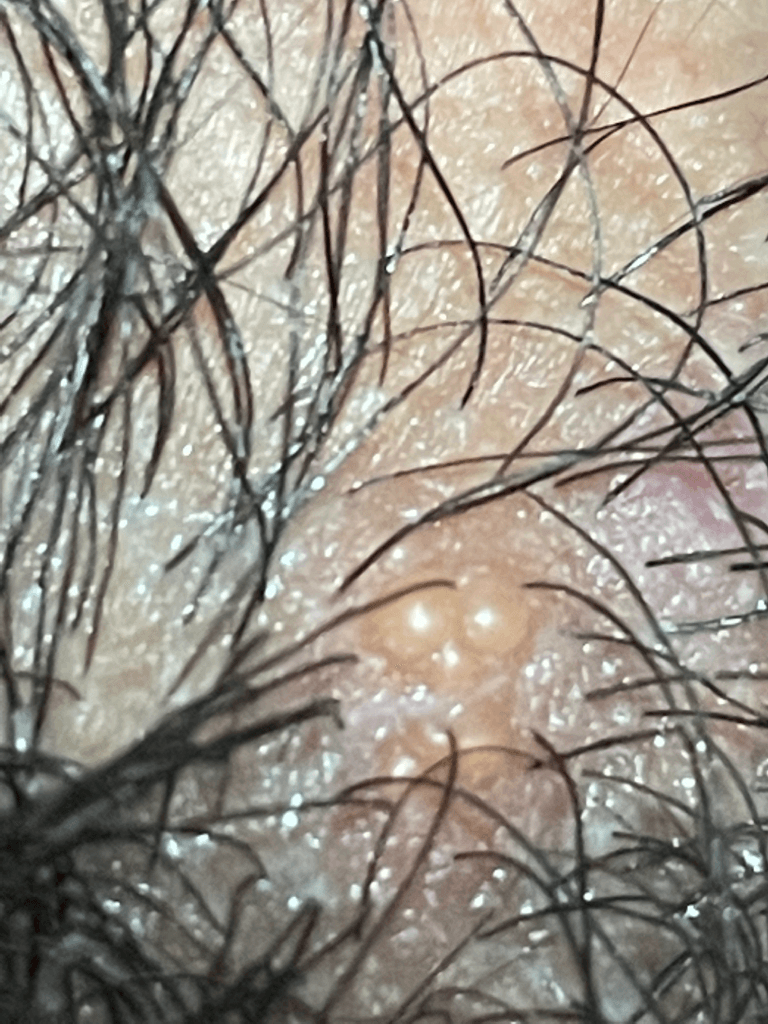 2번 째 사진