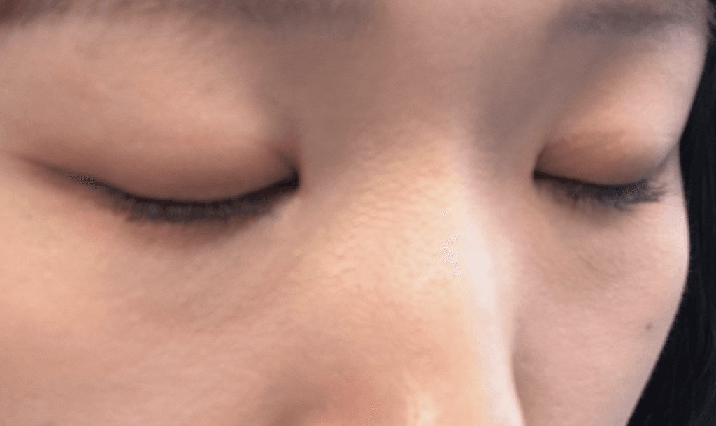 2번 째 사진
