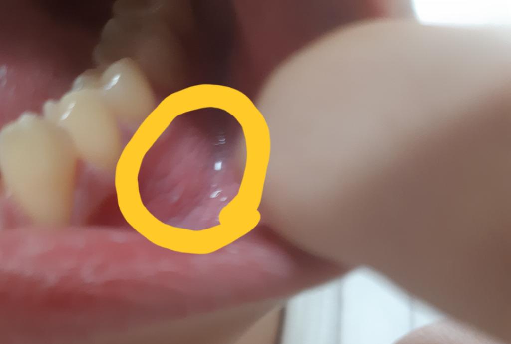 4번 째 사진