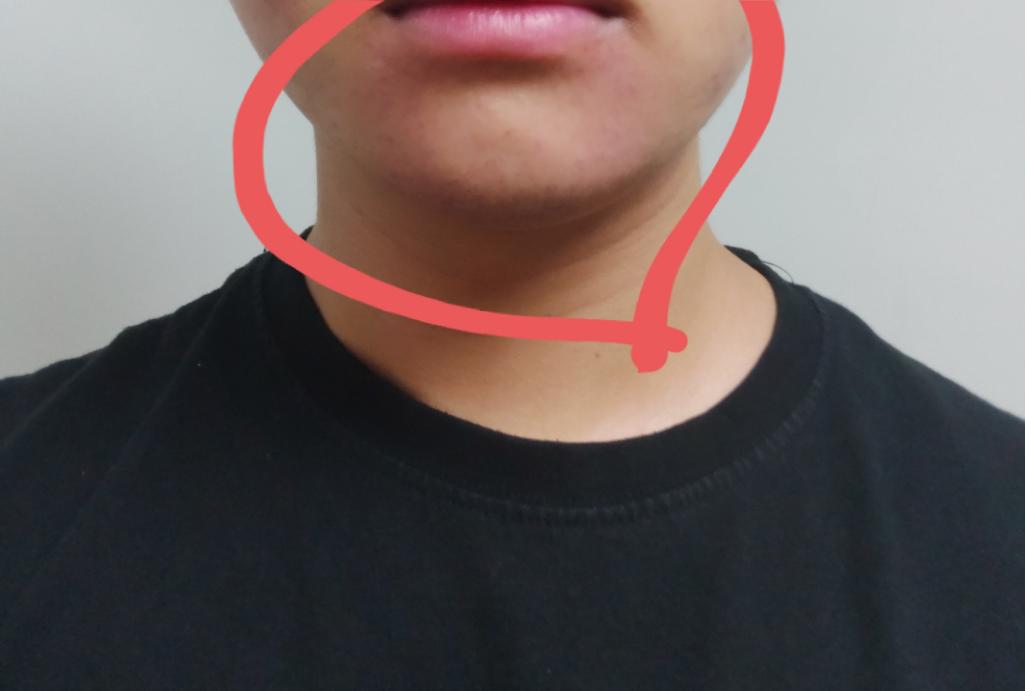 3번 째 사진