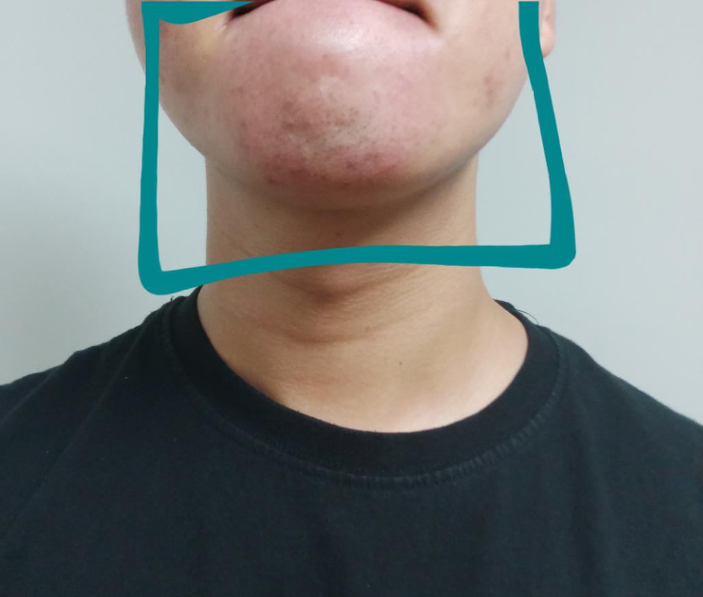 2번 째 사진