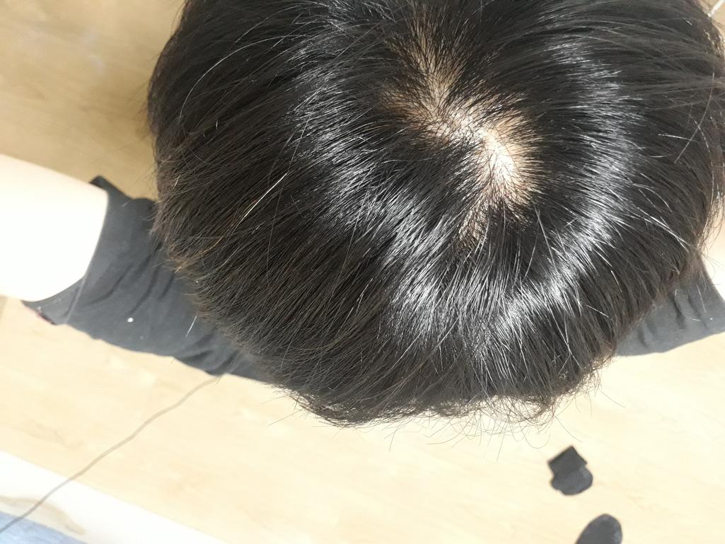 2번 째 사진