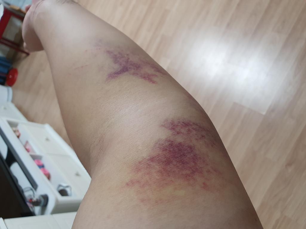 2번 째 사진