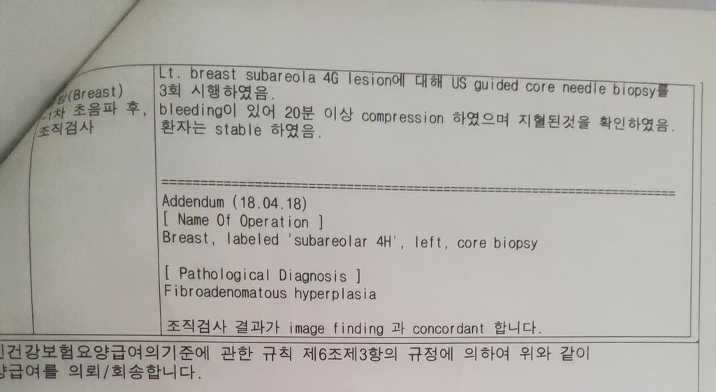 2번 째 사진
