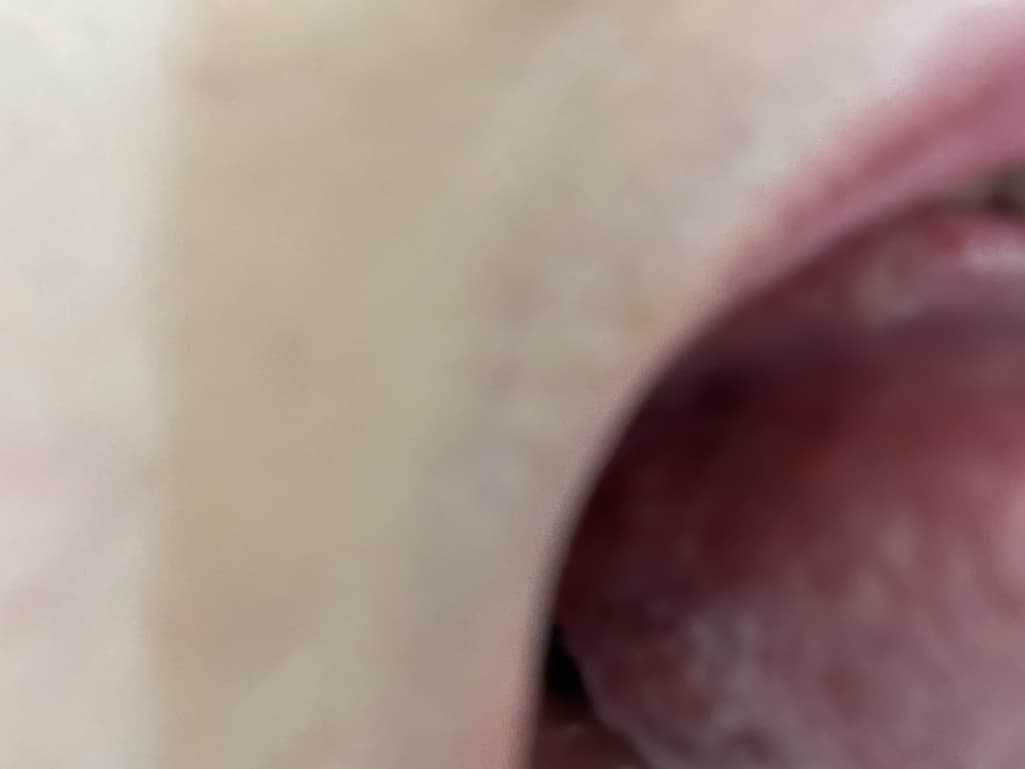 2번 째 사진