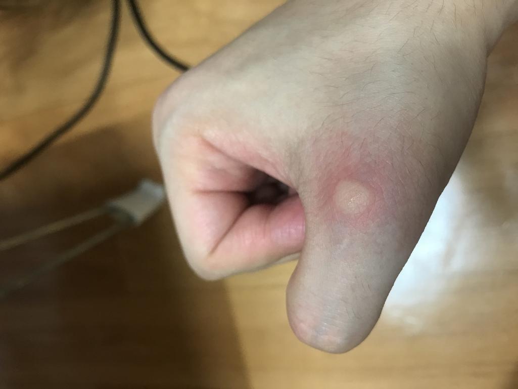2번 째 사진