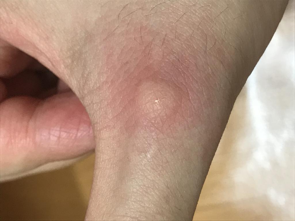 1번 째 사진