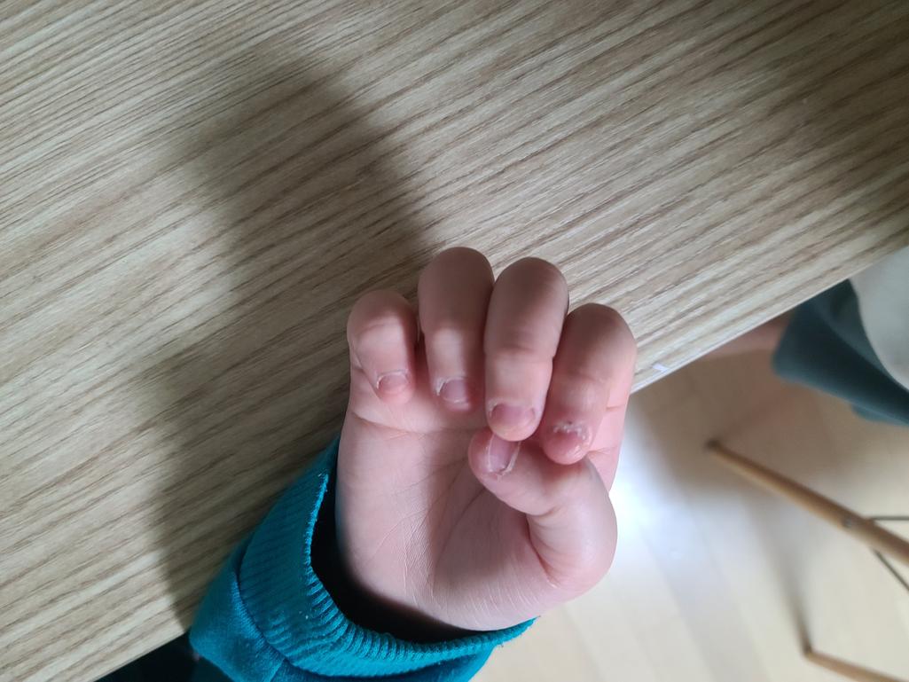 3번 째 사진