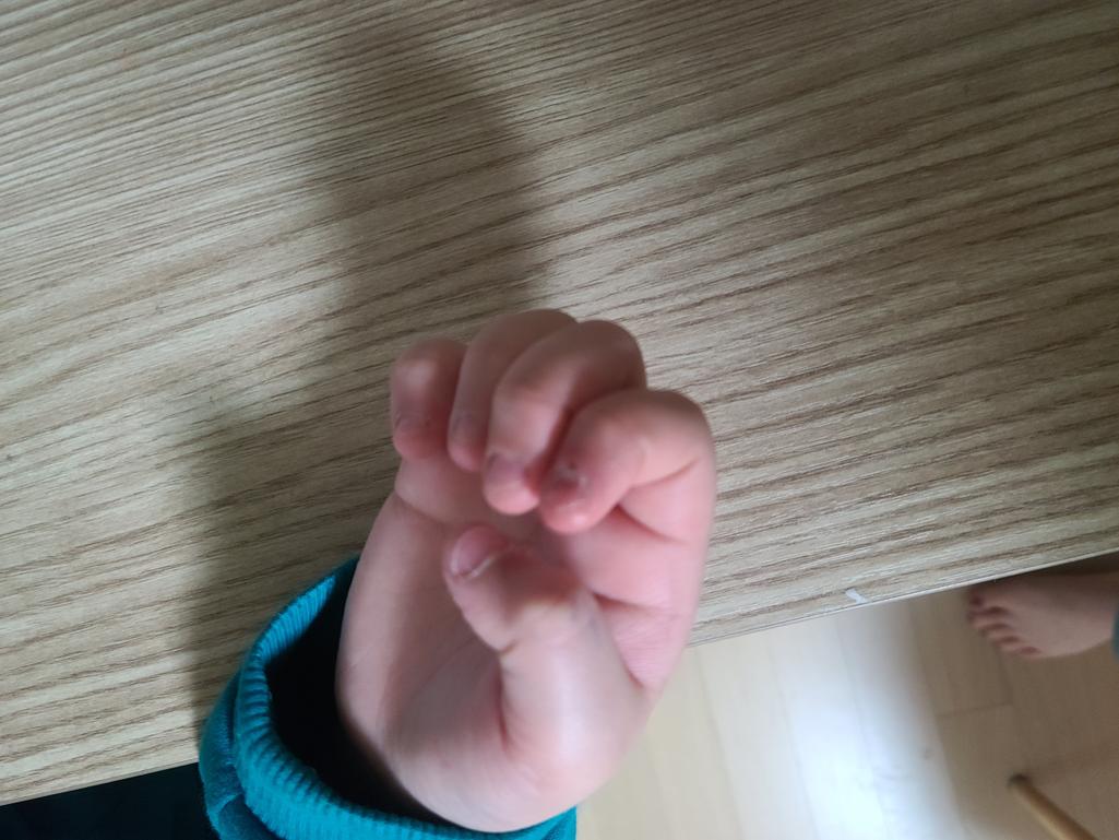 2번 째 사진