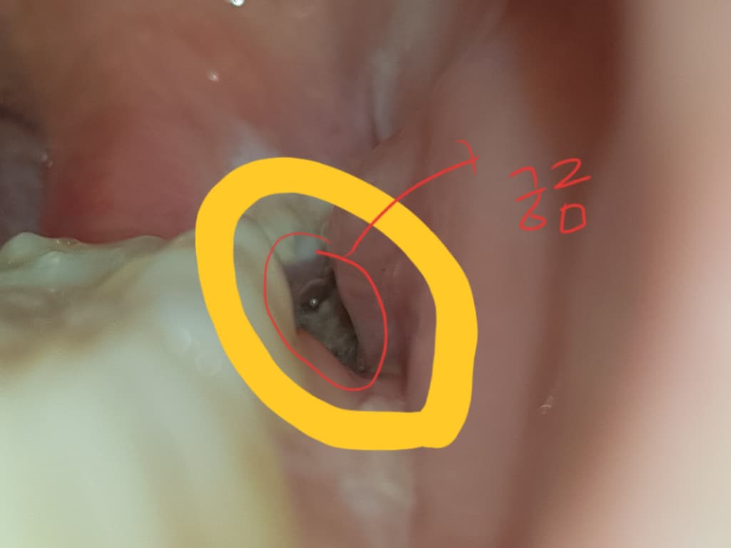 2번 째 사진