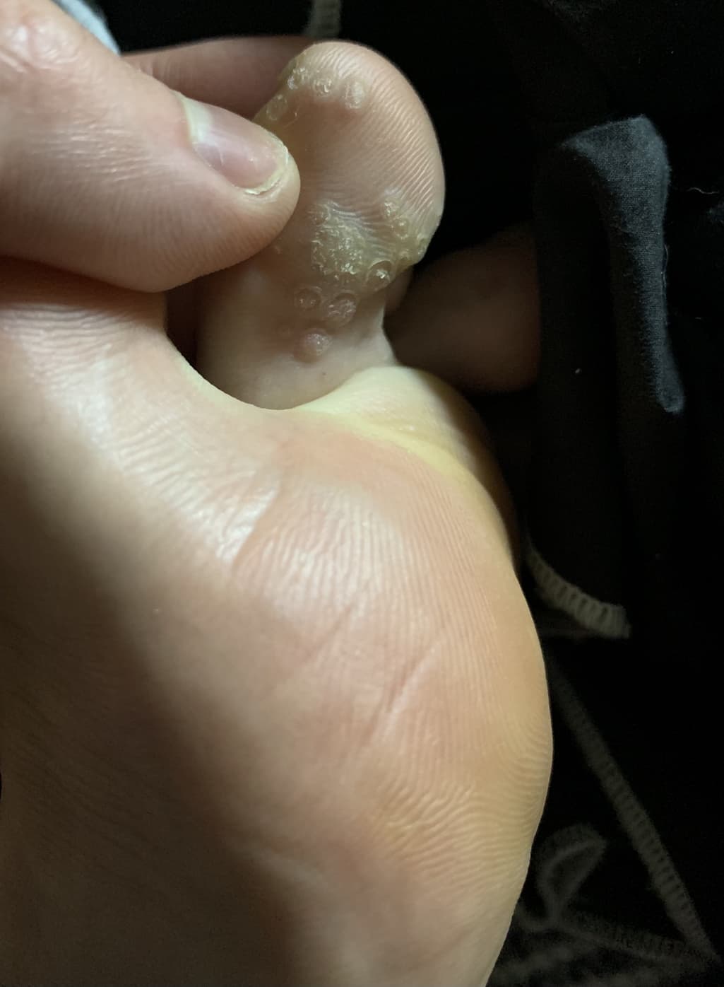 2번 째 사진