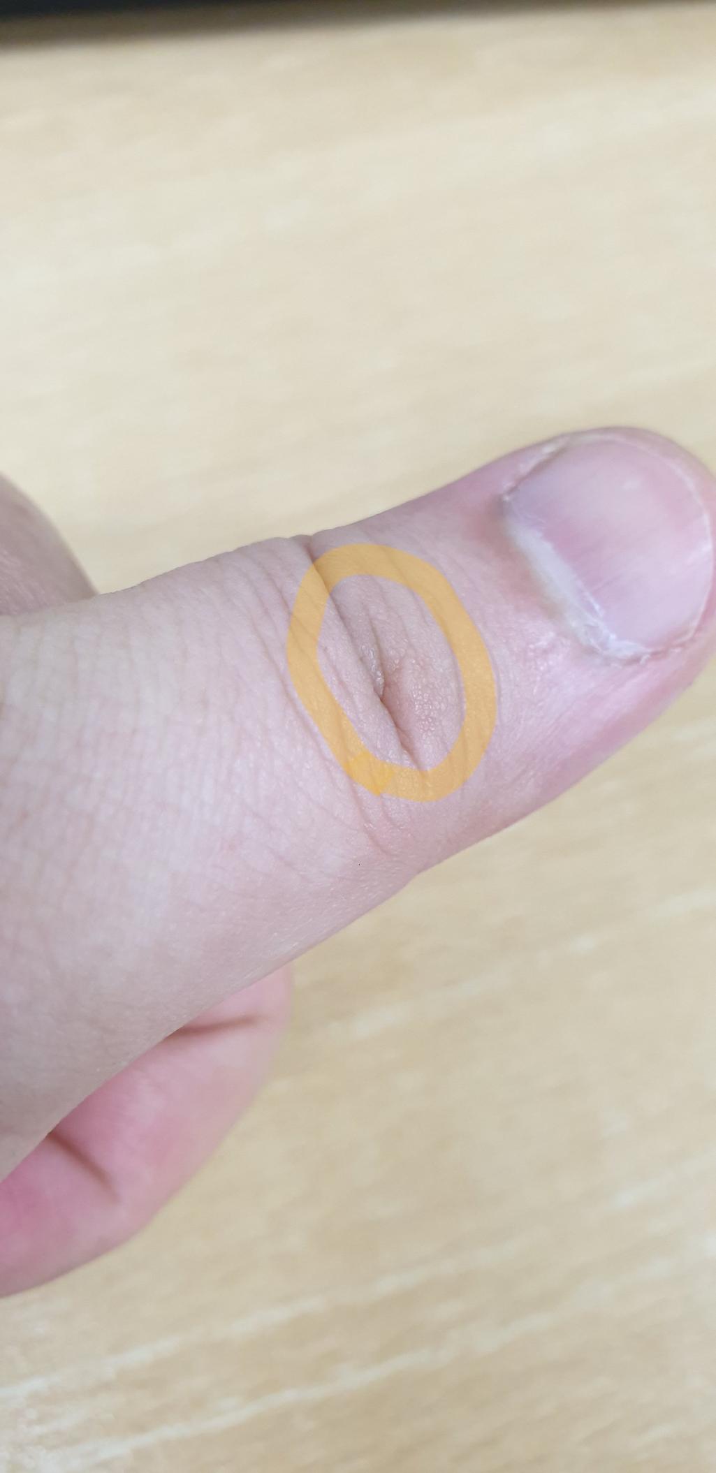 3번 째 사진