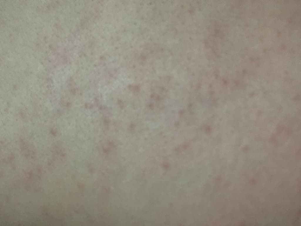 2번 째 사진
