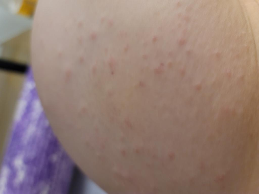 2번 째 사진