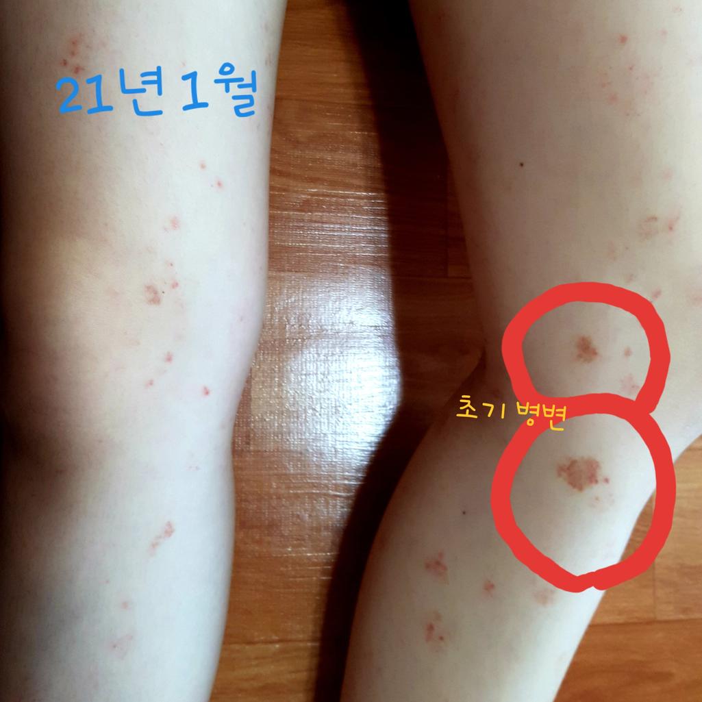 2번 째 사진