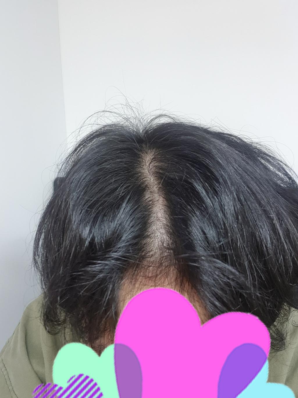2번 째 사진
