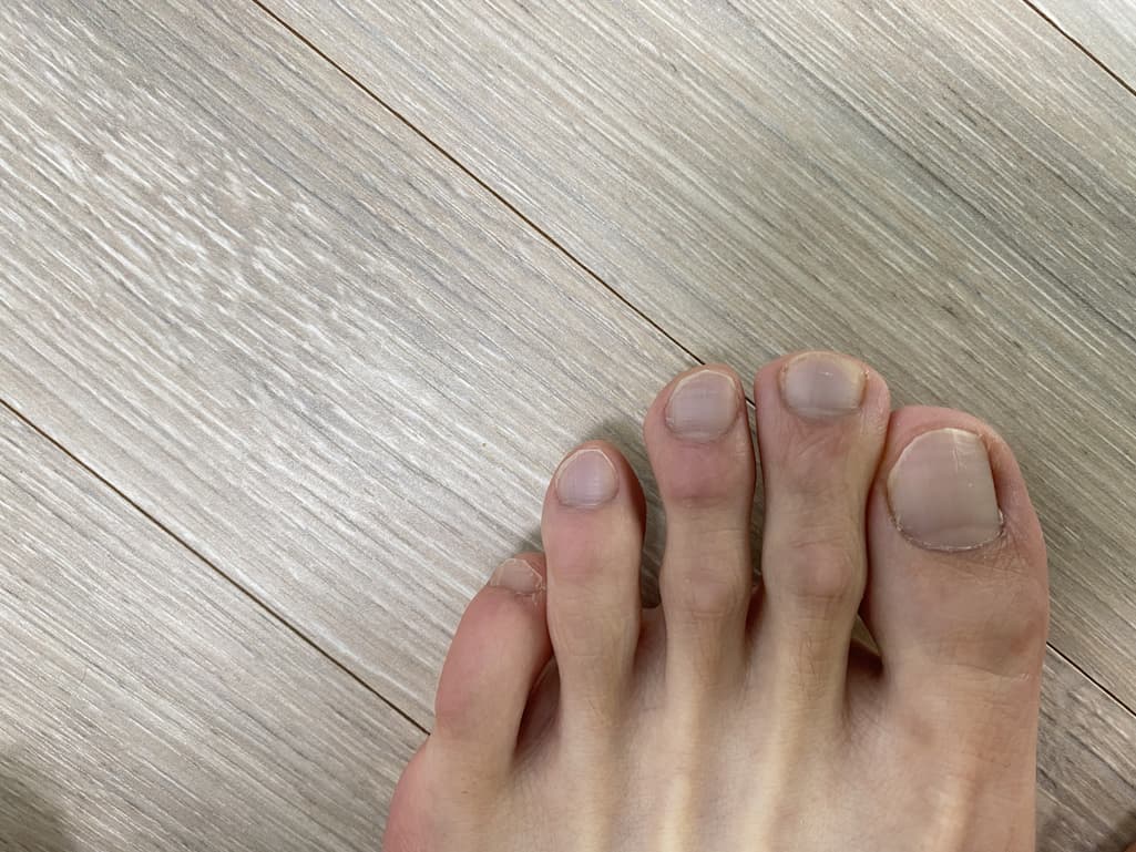 2번 째 사진
