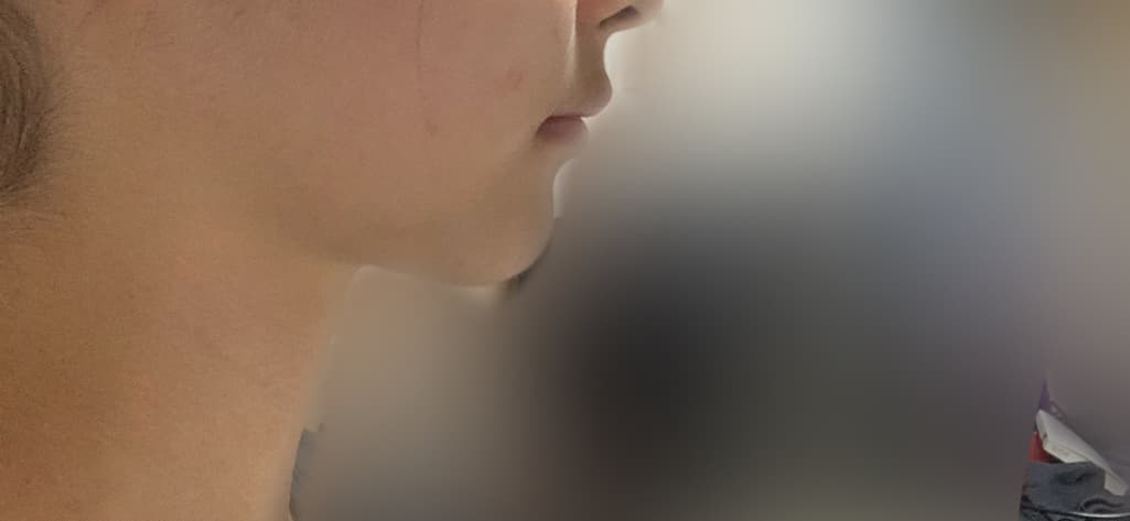 2번 째 사진
