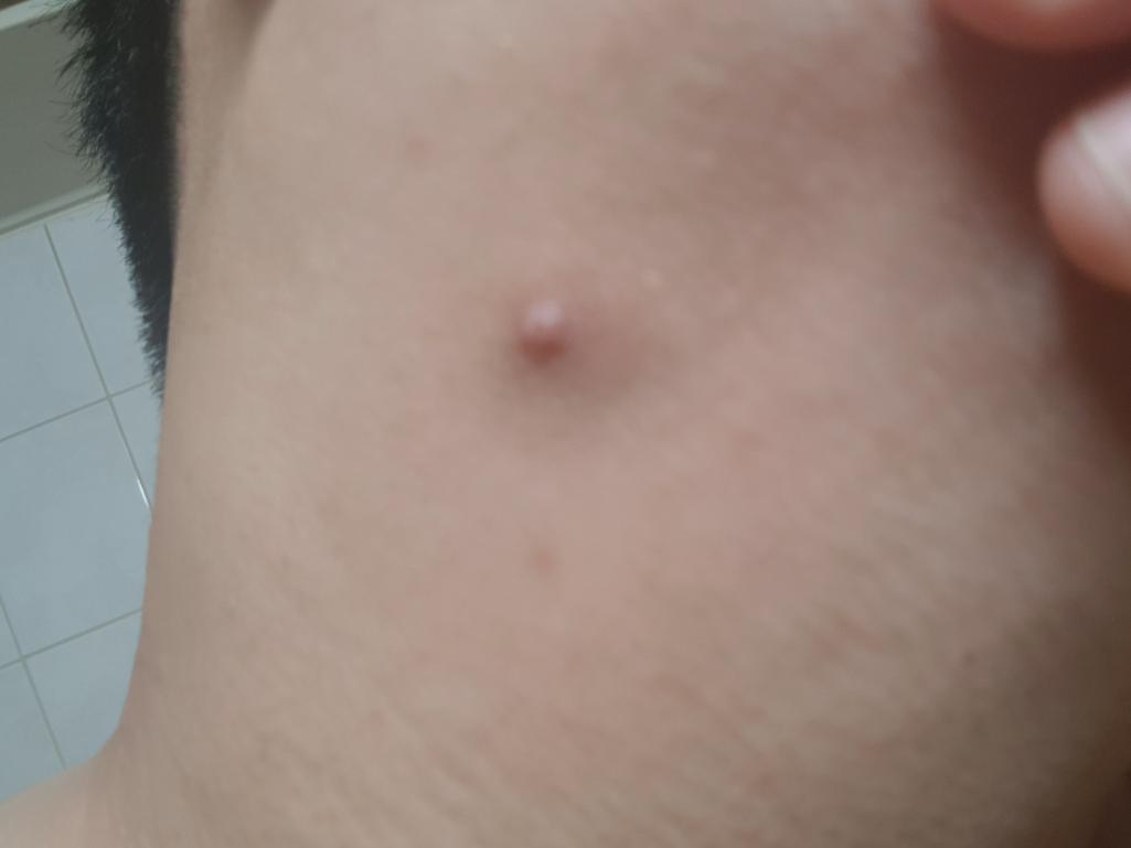 3번 째 사진