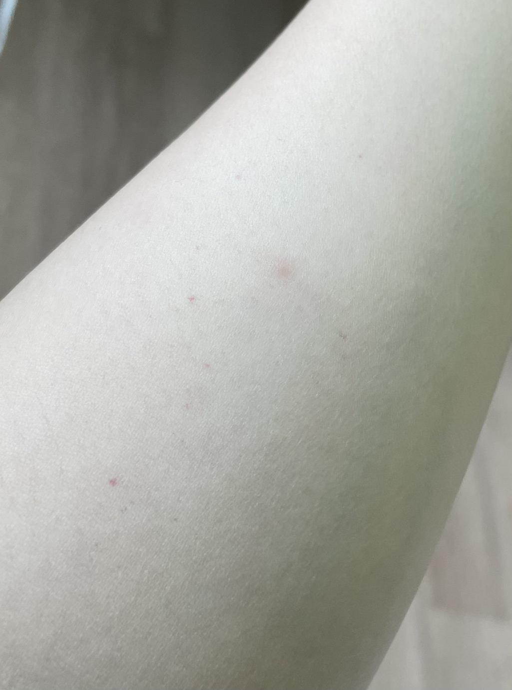 2번 째 사진