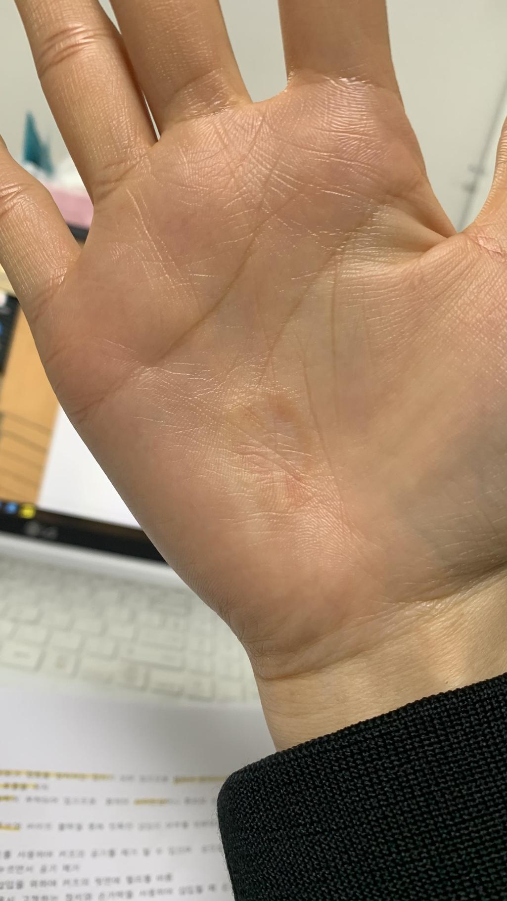 3번 째 사진