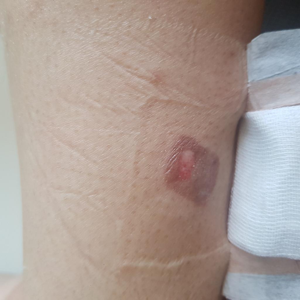 2번 째 사진