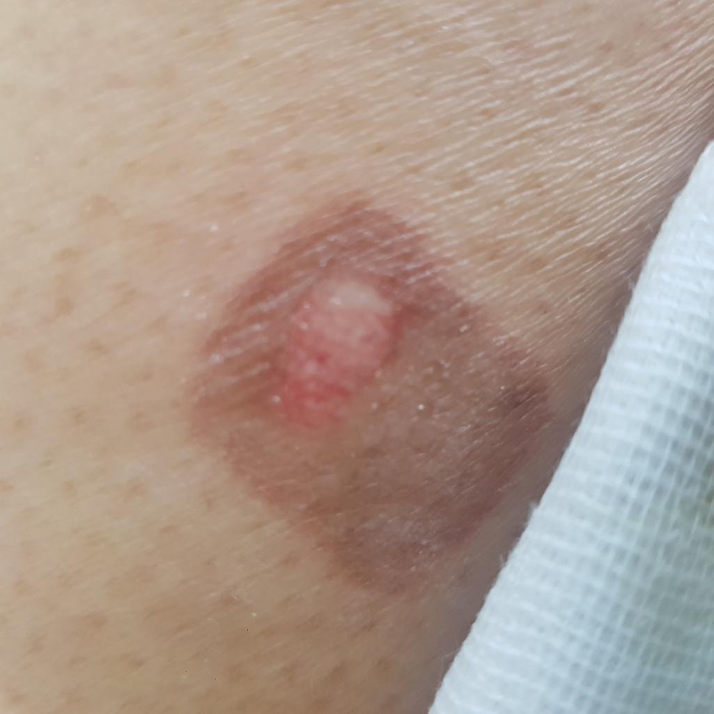 1번 째 사진