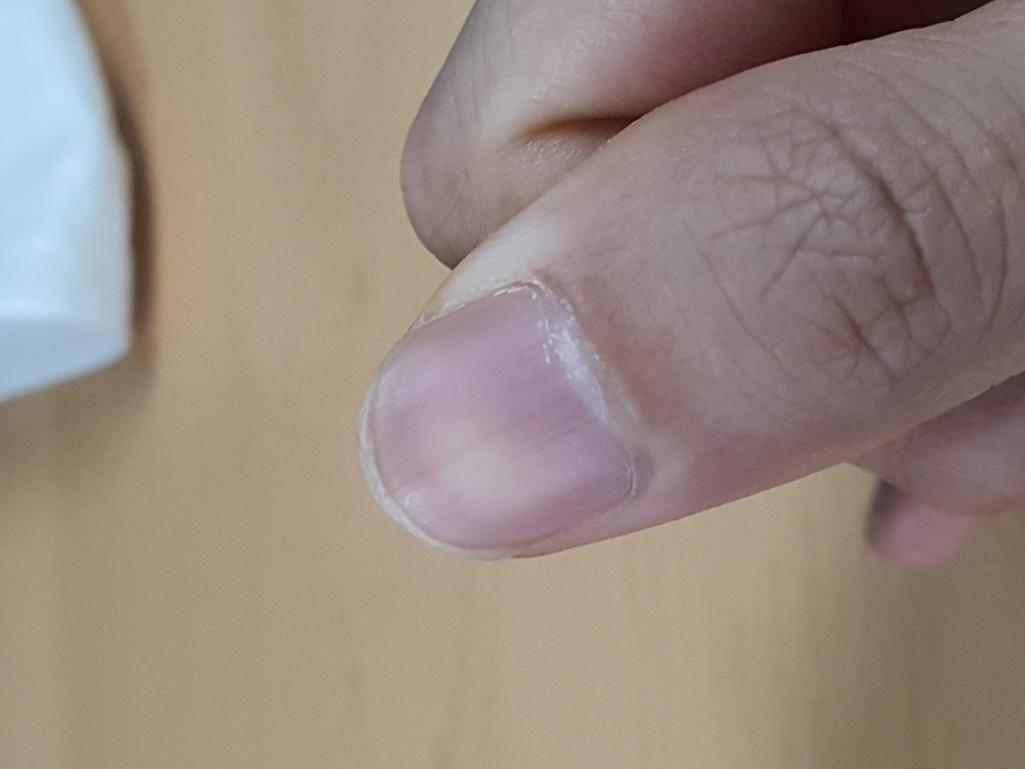 2번 째 사진