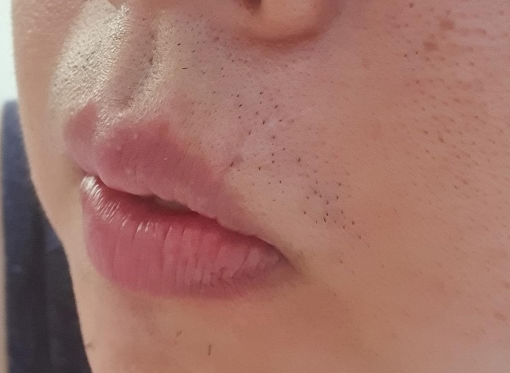 2번 째 사진