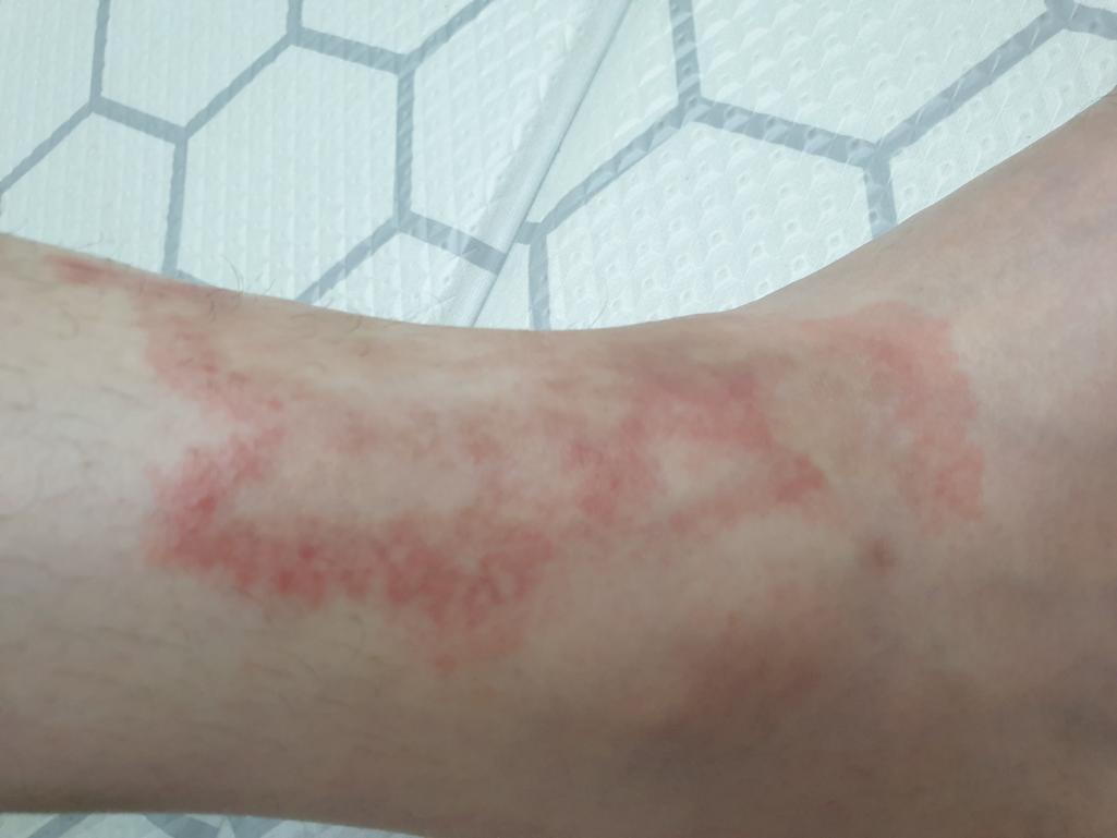 2번 째 사진