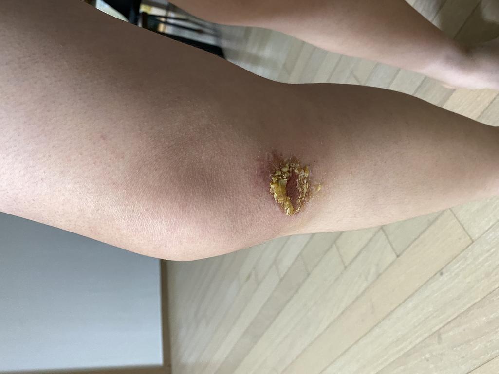 2번 째 사진