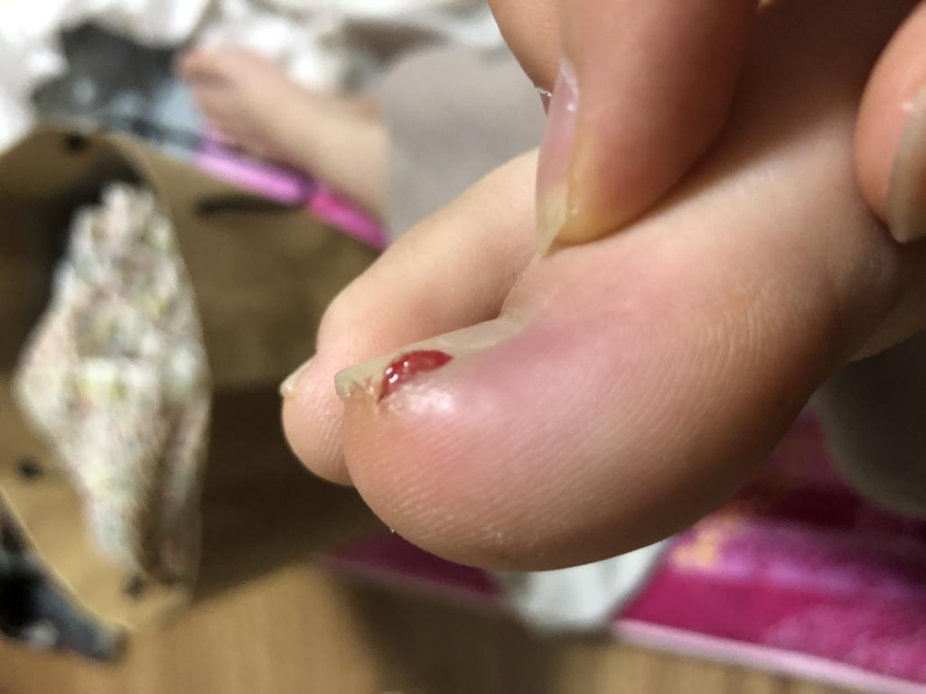 2번 째 사진