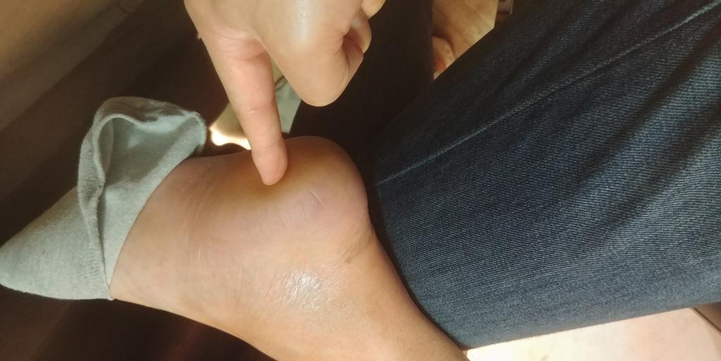 2번 째 사진