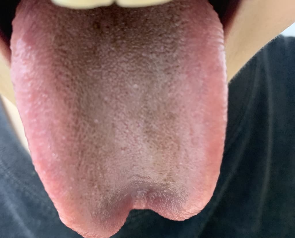 2번 째 사진