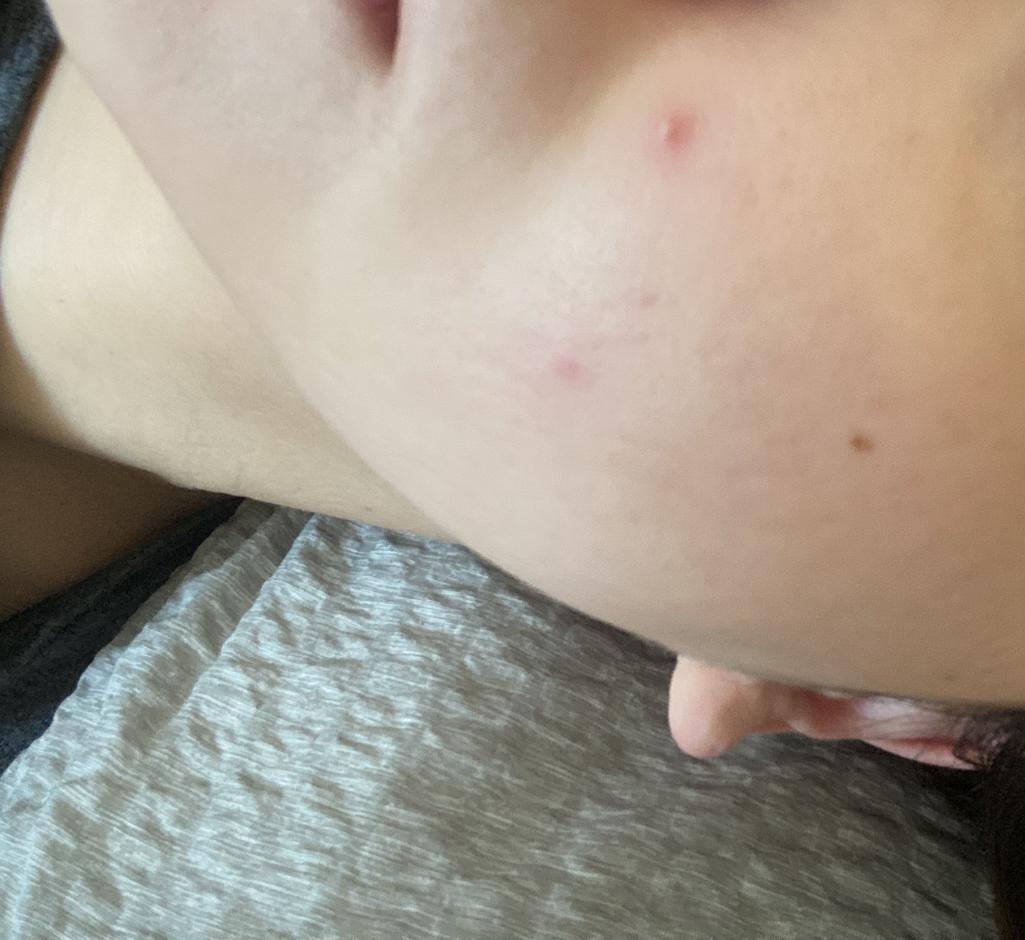 2번 째 사진