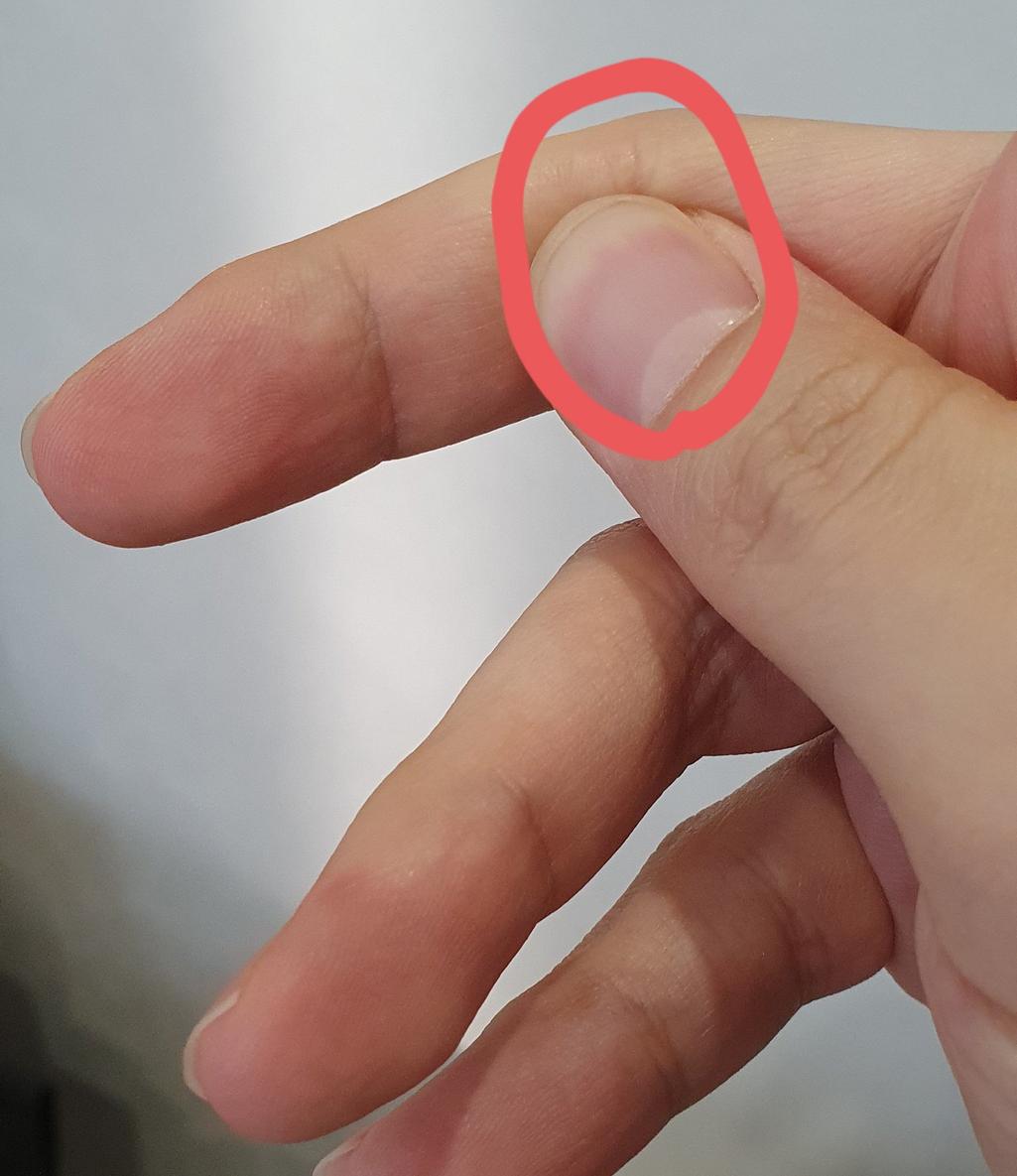 2번 째 사진