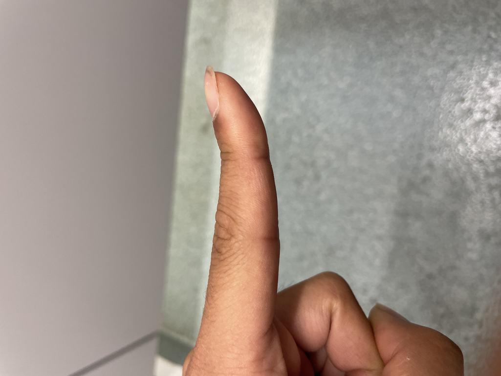 2번 째 사진