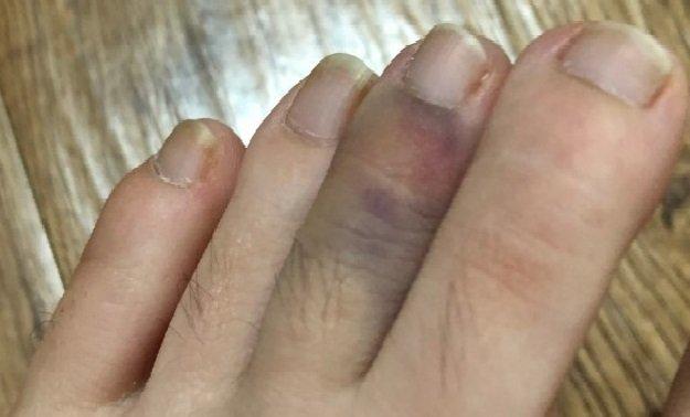 1번 째 사진