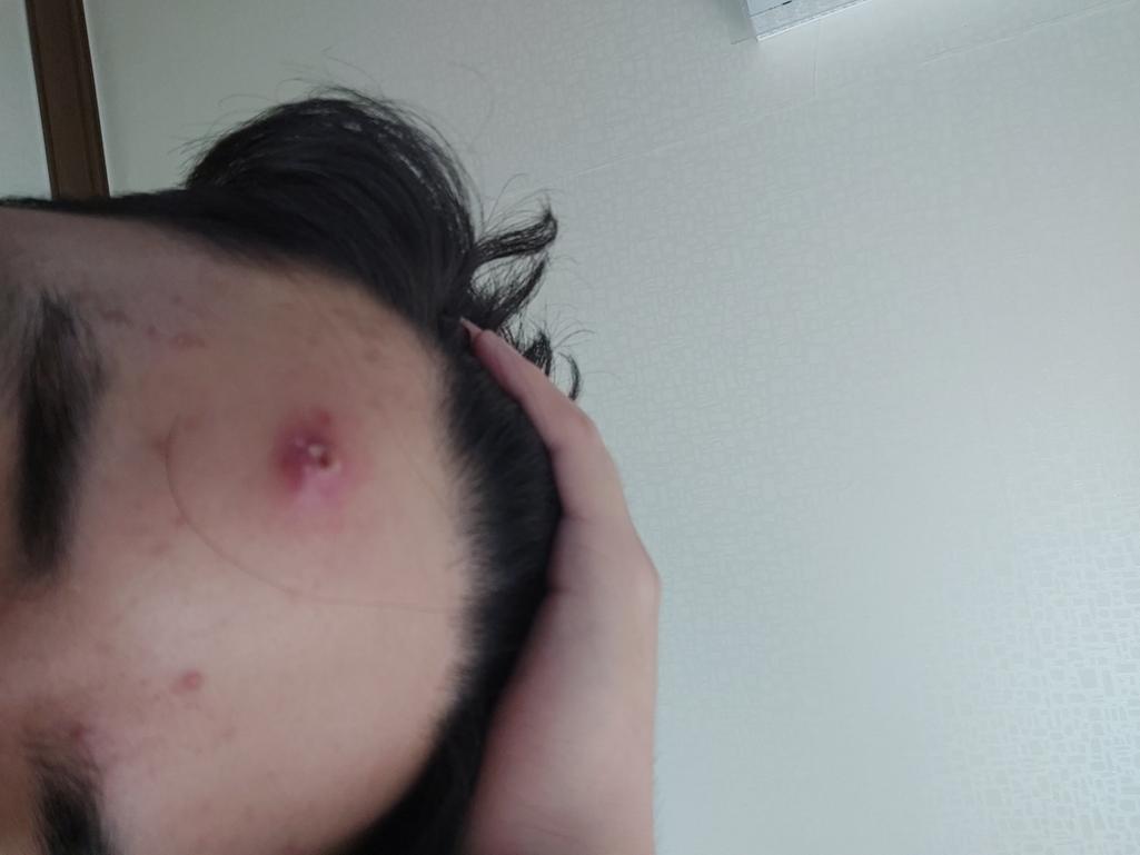 1번 째 사진