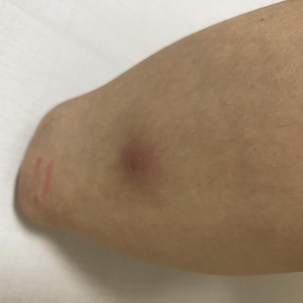 1번 째 사진