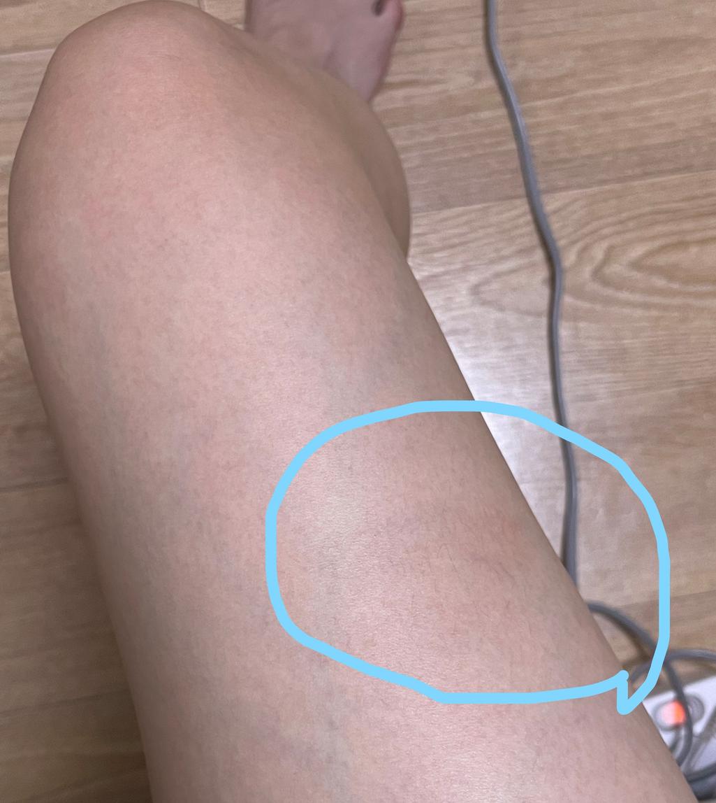 2번 째 사진