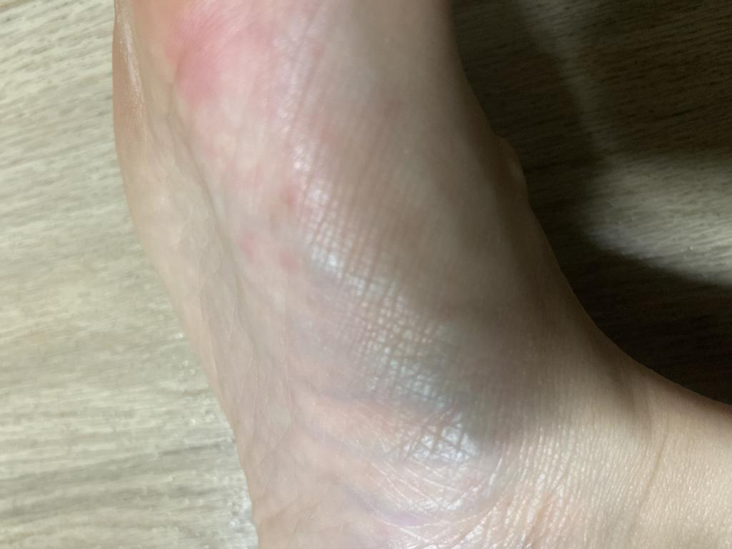 2번 째 사진