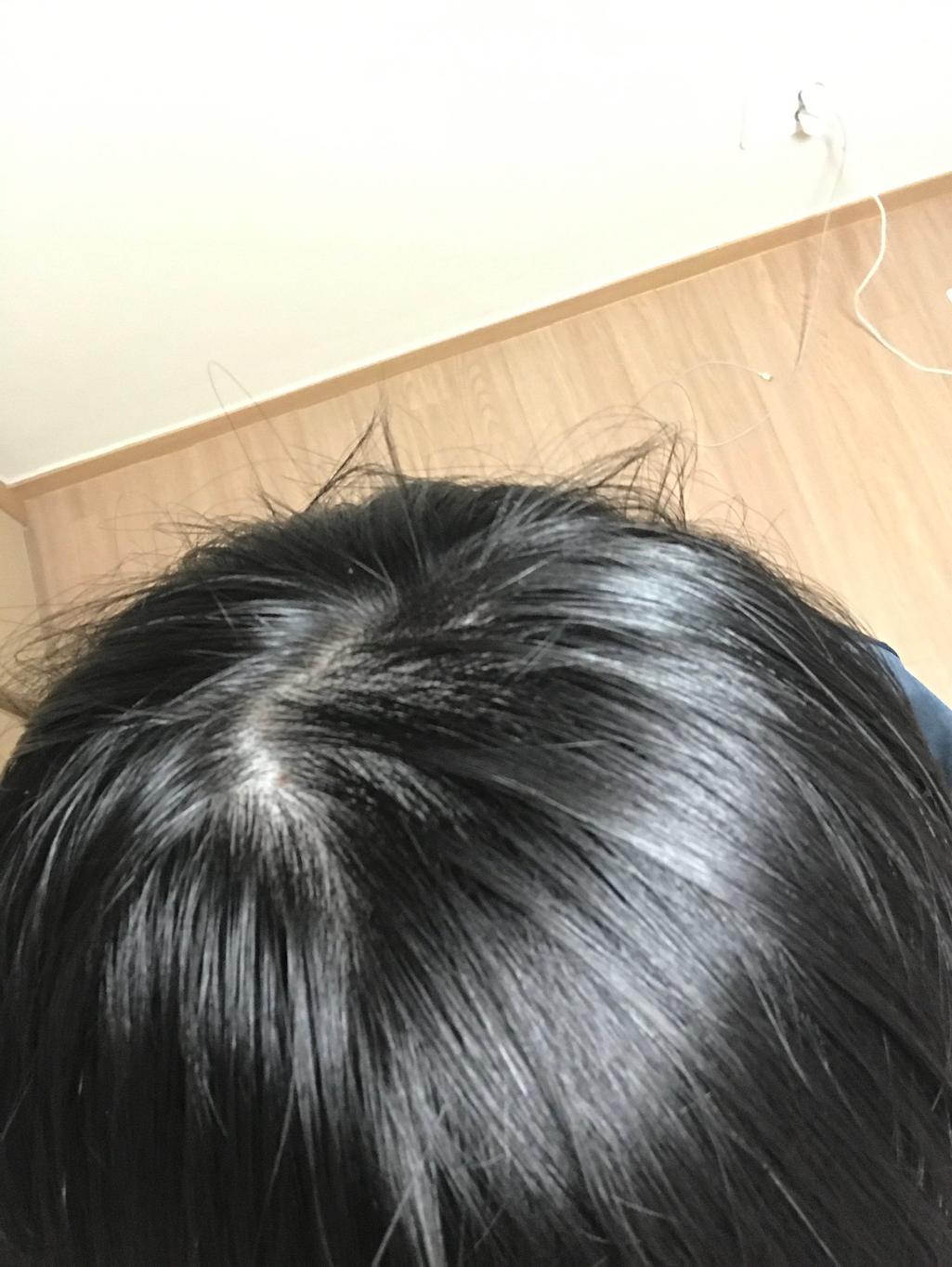 2번 째 사진