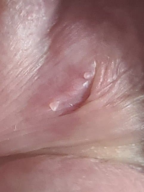 2번 째 사진