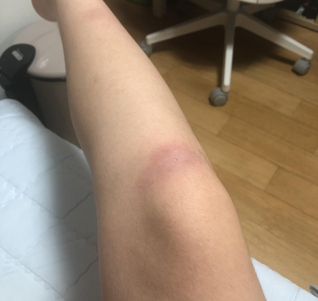 1번 째 사진